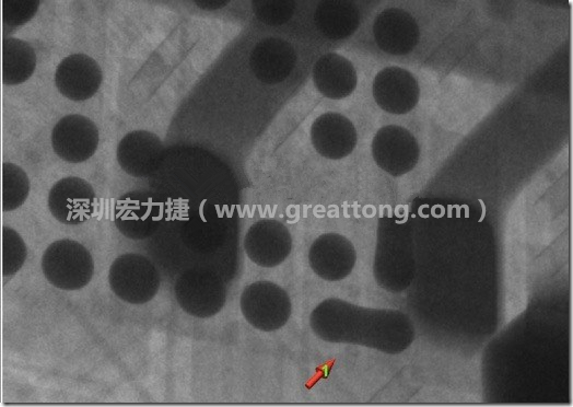 BGA因?yàn)楹笁|變小，造成錫膏過(guò)多而最終形成焊接短路的結(jié)果。